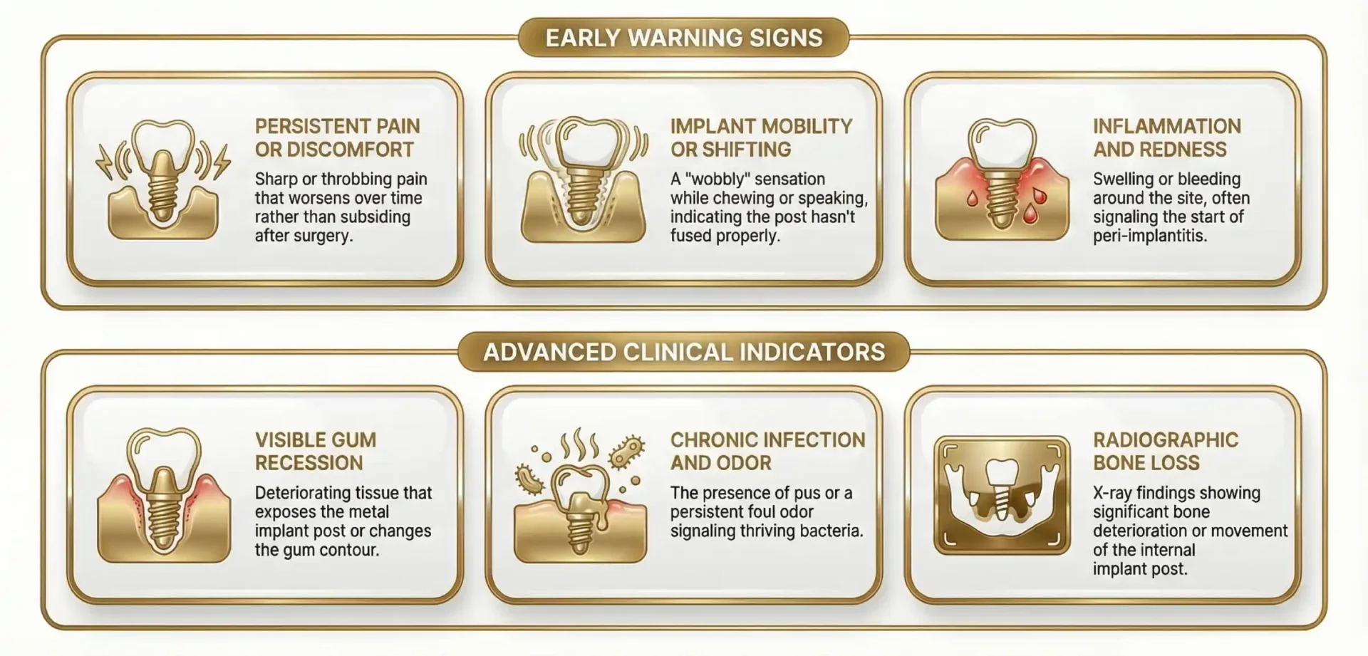 Early and Advance Signs of Dental Implant Failure