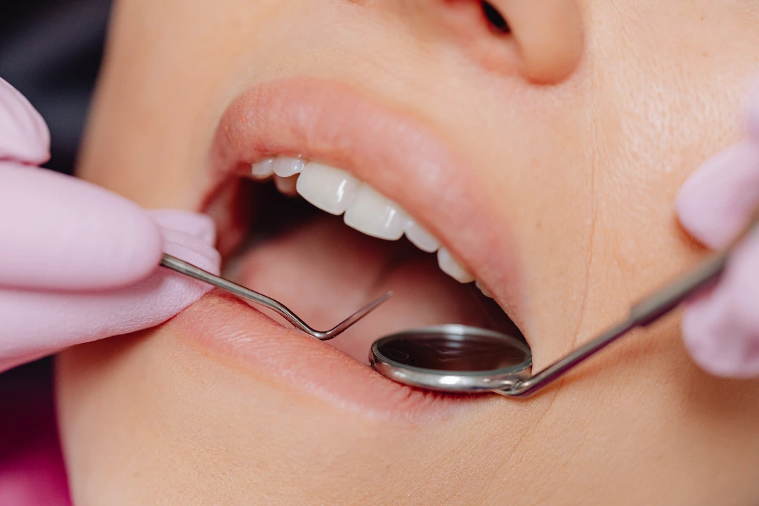Dental Implant Failure Signs