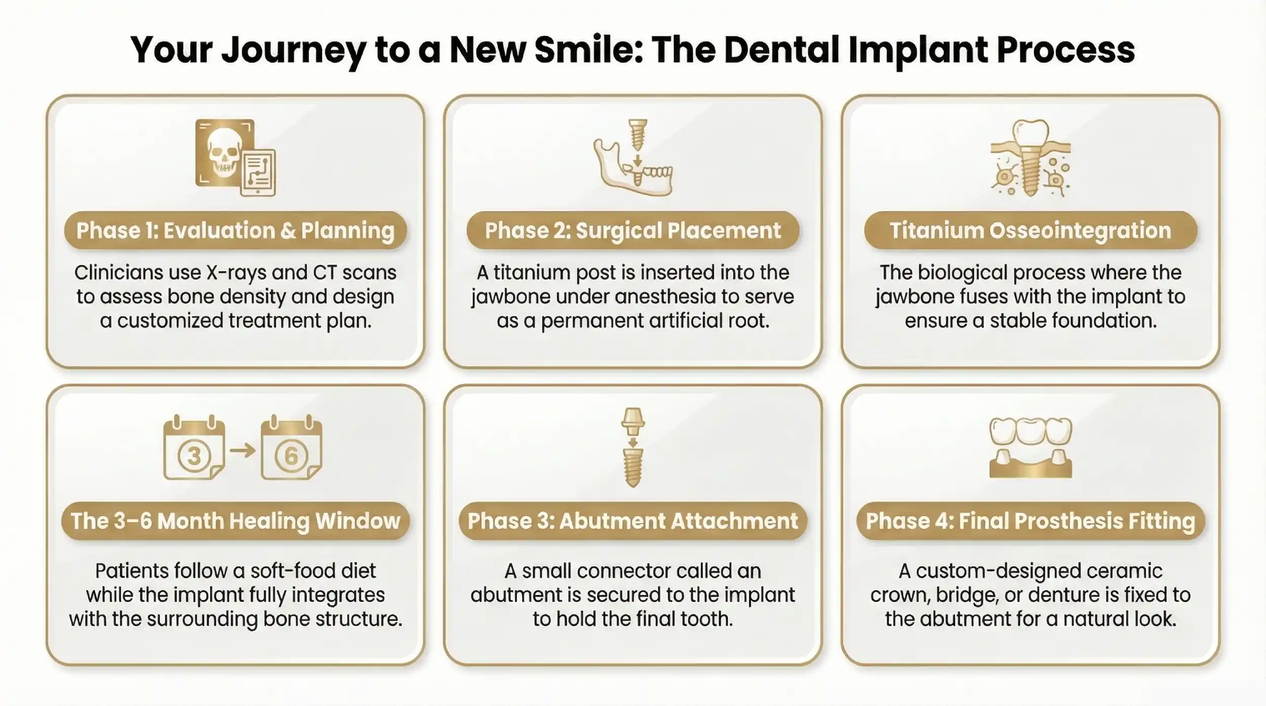 Procedure for Placing Dental Implants