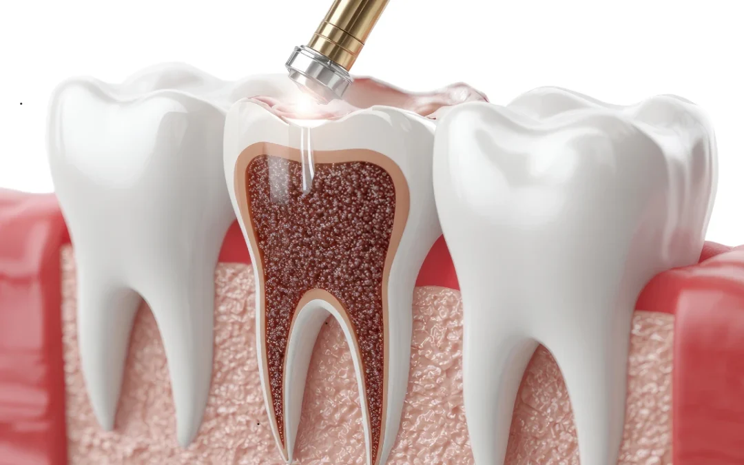 Lost Filling Emergency