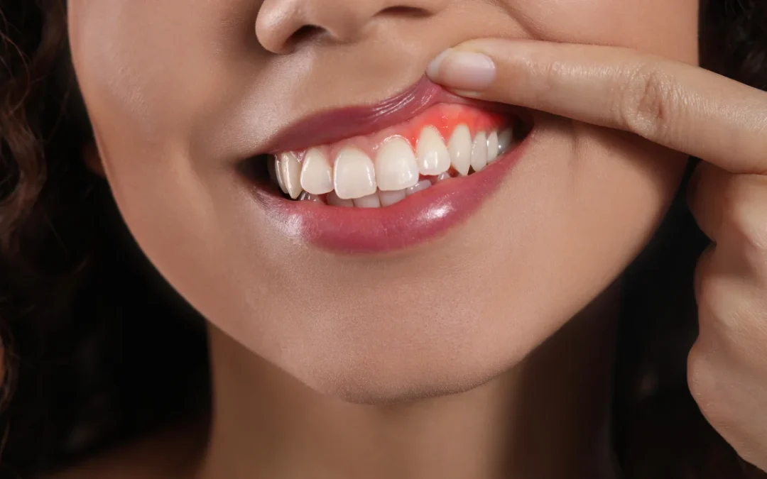 gum recession and sensitive teeth