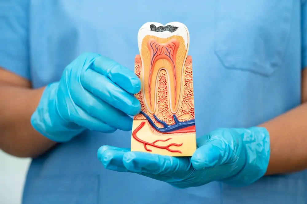 Gloved hands holding an anatomical tooth model showing root canal structure for St Leonards Green Dental patients.